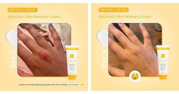 Hướng dẫn sử dụng kem phục hồi Rejuvaskin đúng chuẩn chuyên gia đạt hiệu quả tối đa